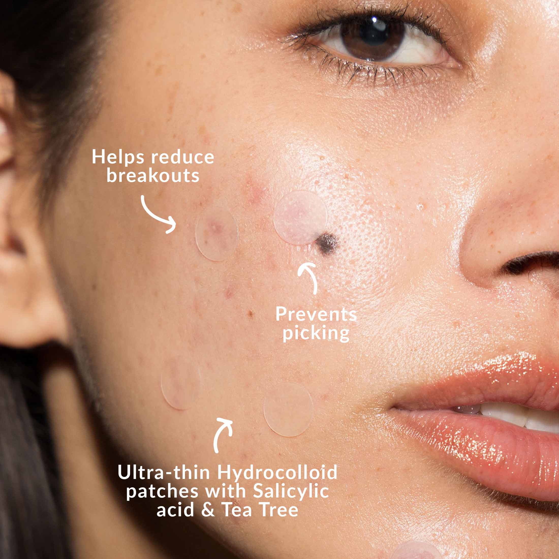 Pimple Patch Dispenser 100 Pack